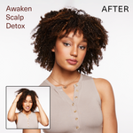 Surface Hair | Awaken Scalp Detox