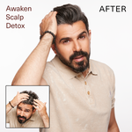 Surface Hair | Awaken Scalp Detox